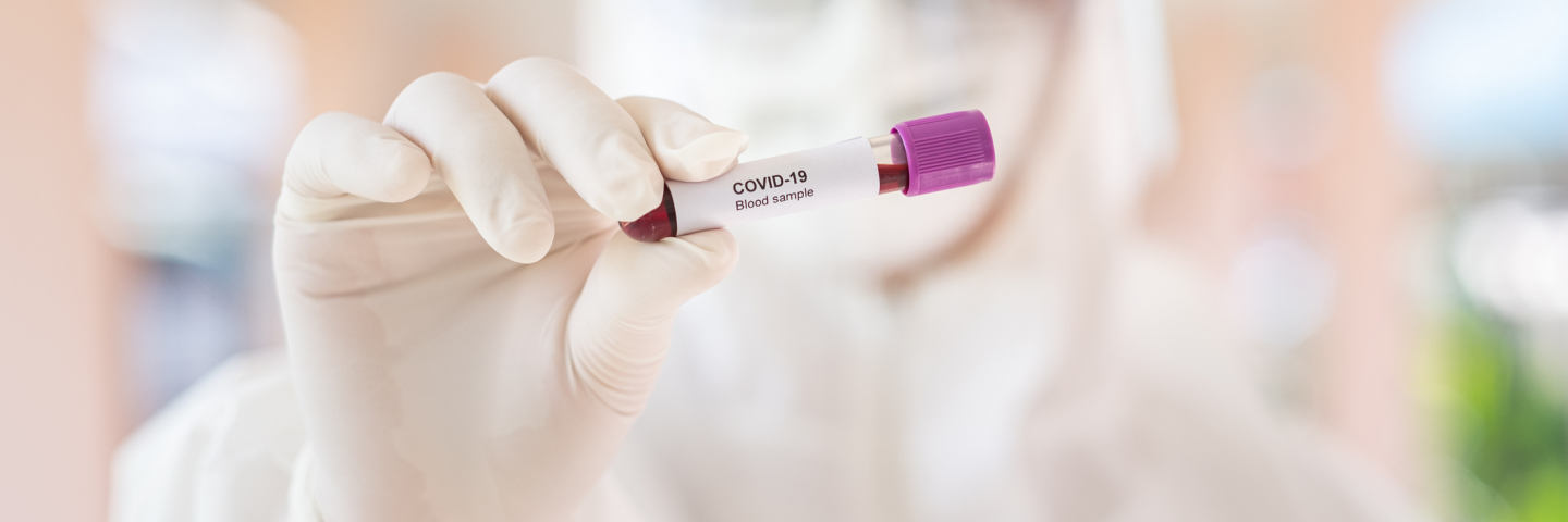 Male doctor holding Covid-19 Blood Sample on White Background